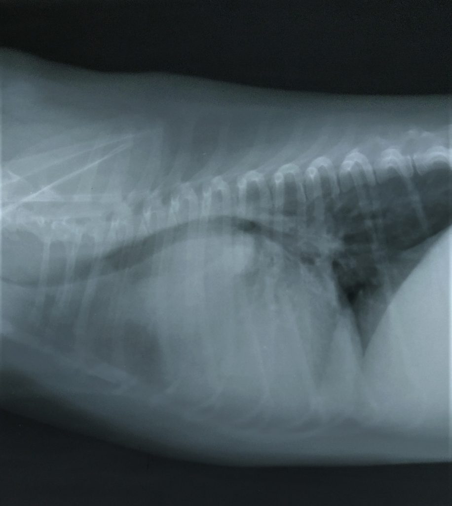 betty radiología lateral derecha tórax