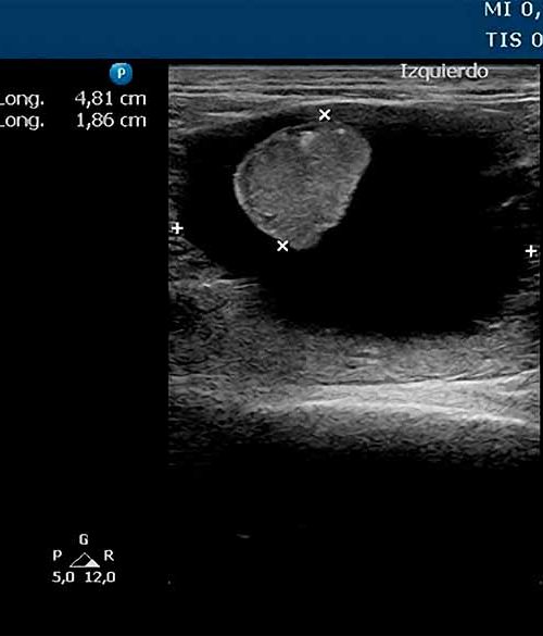Radiografía de un Derrape perirrenal Felino
