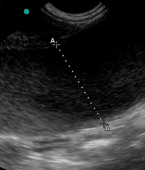 Radiografía de una piometria