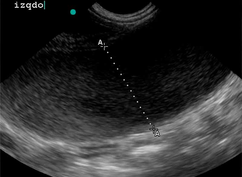 Radiografía de una piometria