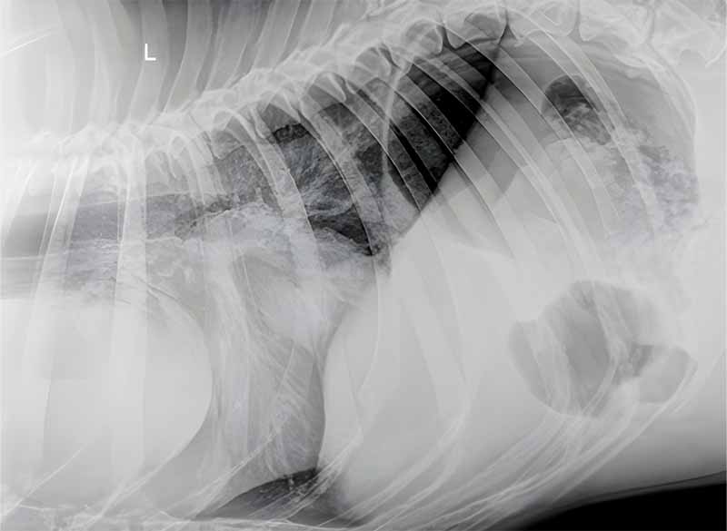 Rayos X de tumor ectópico de tiroides